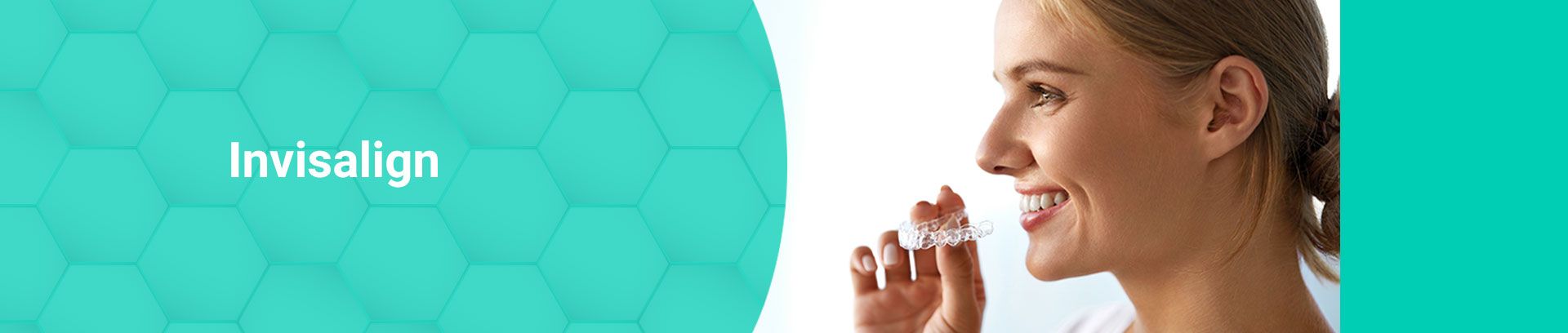 Woman putting in a clear Invisalign aligner