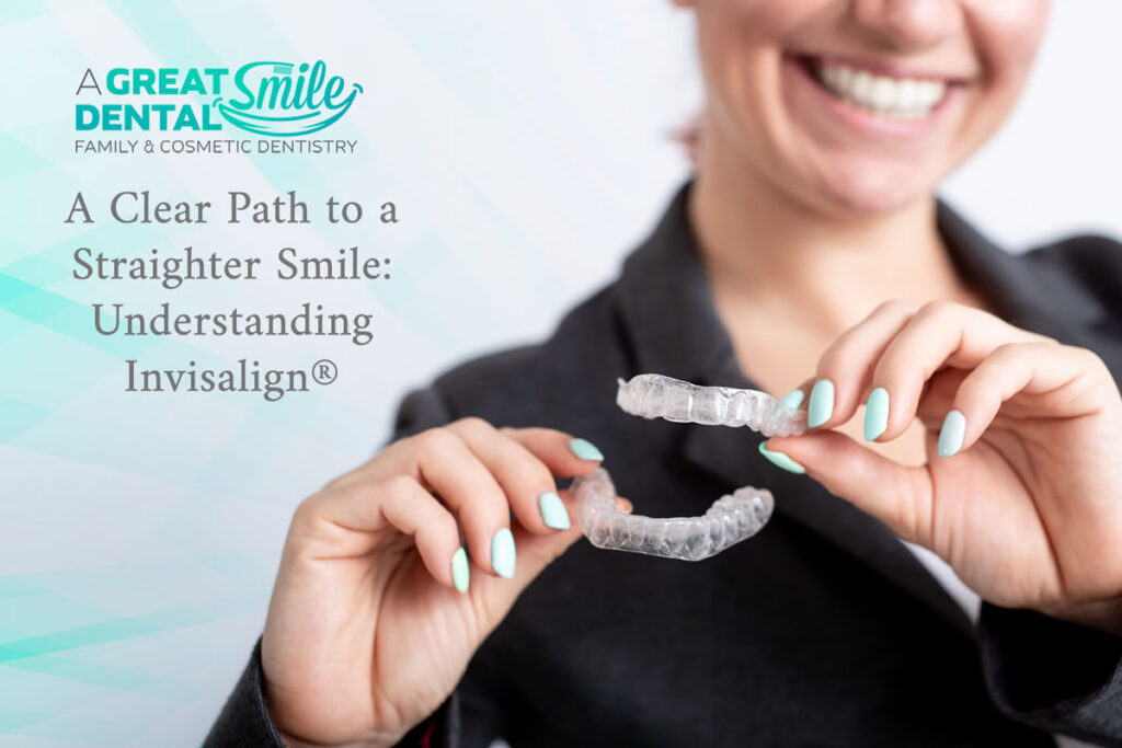 A Clear Path to a Straighter Smile: Invisalign Aligners